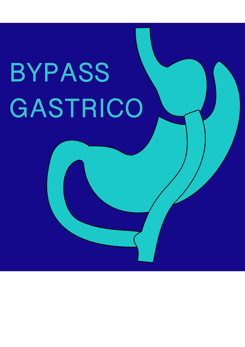 Bypass Gástrico